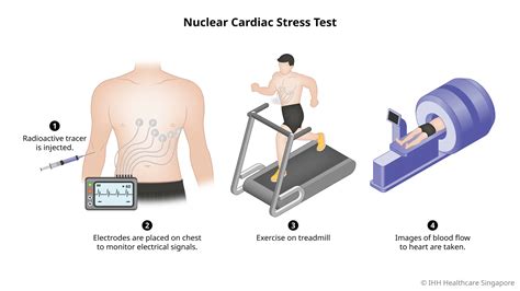 blood pressure drop drastically during nuclear stress test|low blood pressure after nuclear test.